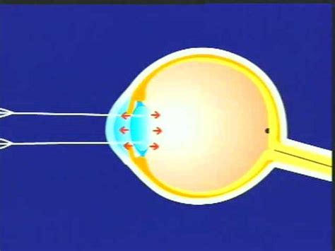 香港科大设计出世界首个3D人工眼球，比人眼看得更远更清楚