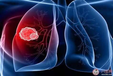 低剂量螺旋ct可早期发现肺癌 肺癌的早期表现有哪些 _八宝网