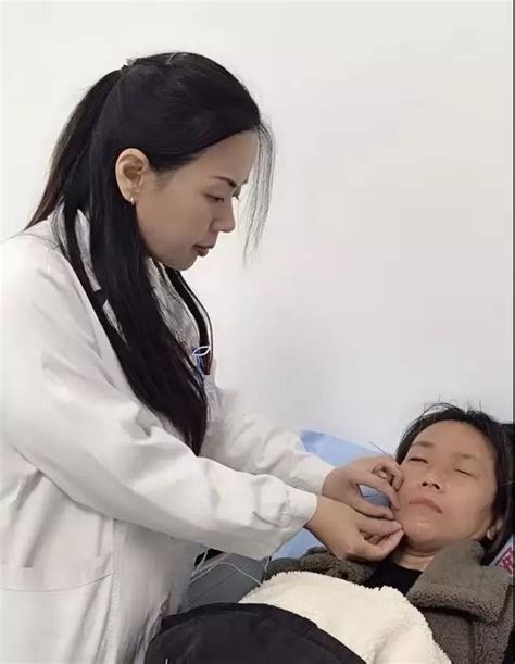 针灸治疗面瘫 让面瘫患者笑靥如初_山东省济宁市第一人民医院