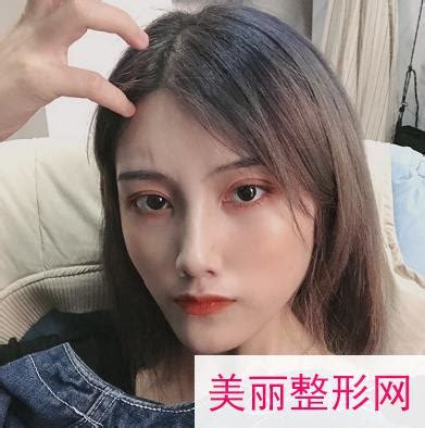 成都八大处整形医院隆鼻医生_案例_2020价格明细表出炉_美嘉整形网(美学知识)