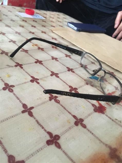 戴眼镜的这几大禁忌，眼镜坏了不都是因为质量问题！-健眼常识-野光源在线商城