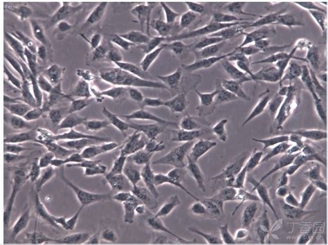 MOLP-2 多发性瘤细胞品牌：ATCC公司，ScienCell细胞美国/国内传代-盖德化工网