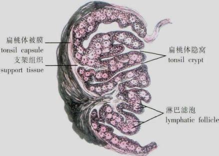 扁桃体结石图片