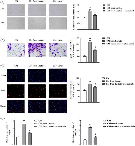 Lactate secreted by esophageal cancer cells induces M2 macrophage ...