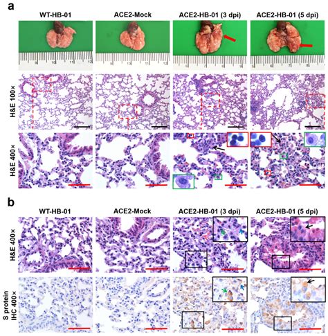 阿尔茨海默病病变区FoxG1过表达小鼠模型的构建方法及应用与流程