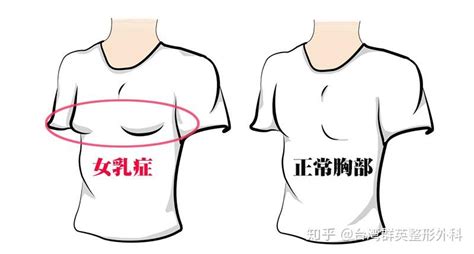 女性乳头图片