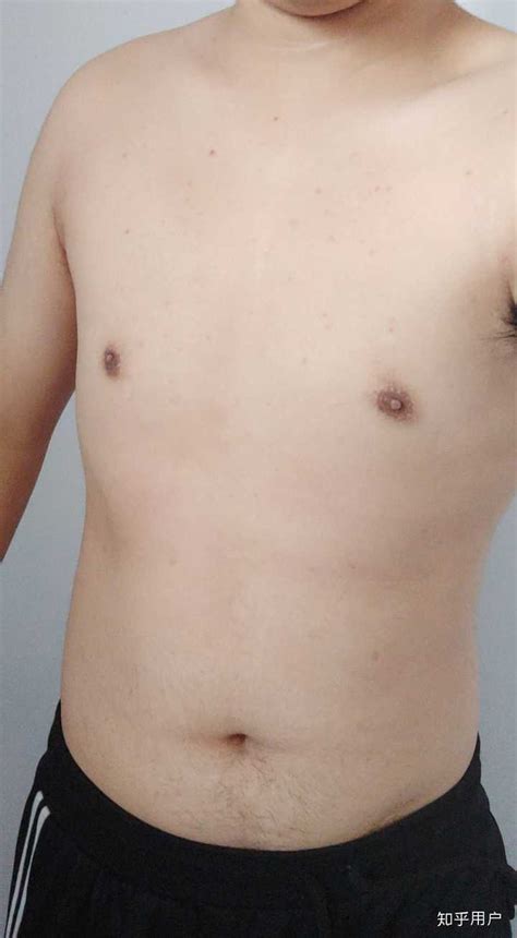 正常乳头图片