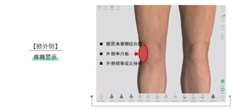 膝盖各个部位疼痛图解(3)_配图网