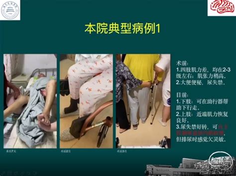 首都医科大学附属天坛医院