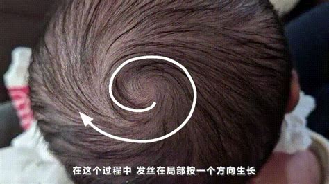 为什么人会长发旋，1 2 3个发旋分别代表什么？|长发|中心点|遗传_新浪新闻
