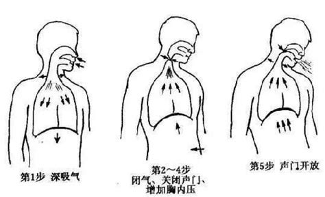 胸腔闭式引流，这四点你未必懂_胸腔积液_气胸_胸腔闭式引流_医脉通