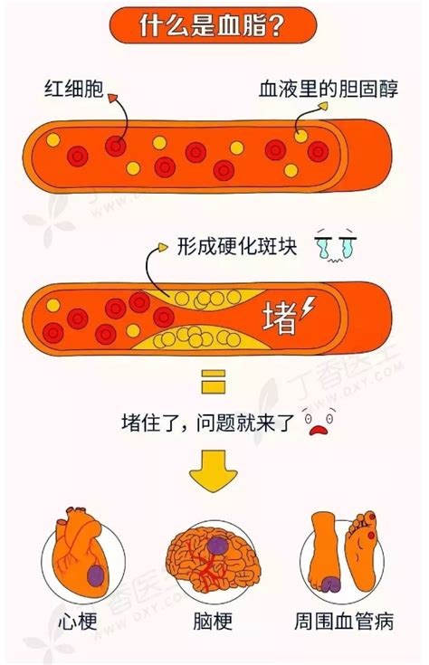 一张图帮你看懂血脂、胆固醇-健康教育-漯河市中心医院
