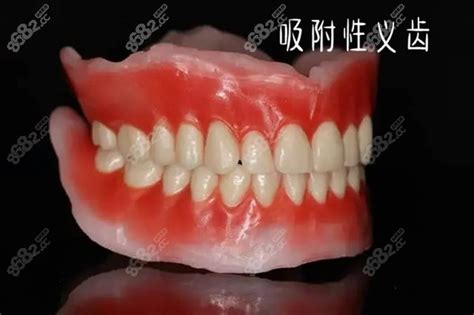 bps吸附性义齿和纯钛支架义齿有啥区别？全口义齿该选啥？,牙齿修复-8682赴韩整形网