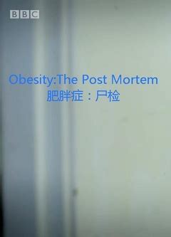 《解剖肥胖》-高清电影-完整版在线观看