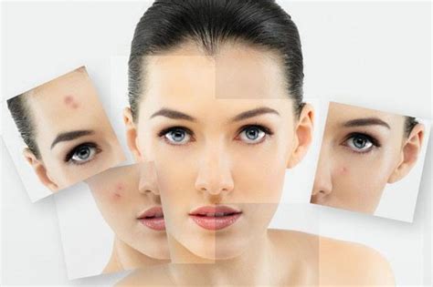 【图】皮肤过敏治疗方法 是什么原因造成的_皮肤_伊秀美容网|yxlady.com