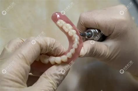 日式无种植仿生牙和种植牙有啥不同?难道就是BPS吸附性义齿?,种植牙-8682赴韩整形网