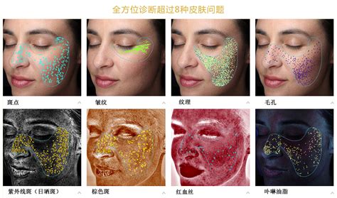 皮肤病有哪些种类图片及名称-中华银屑病网