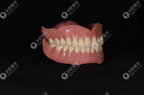 全口假牙既想要价格便宜又想要舒适,速来看这几款活动义齿 - 口腔资讯 - 牙齿矫正网