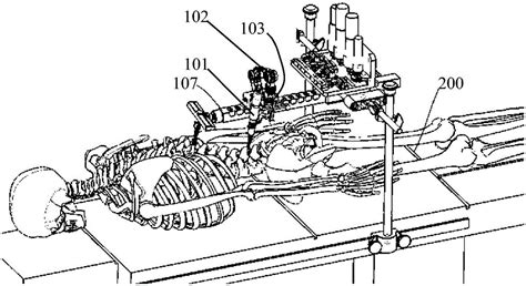 骨质磨削机器人、椎板磨削手术机器人控制系统及方法与流程