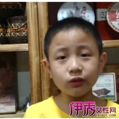 男孩包皮图片