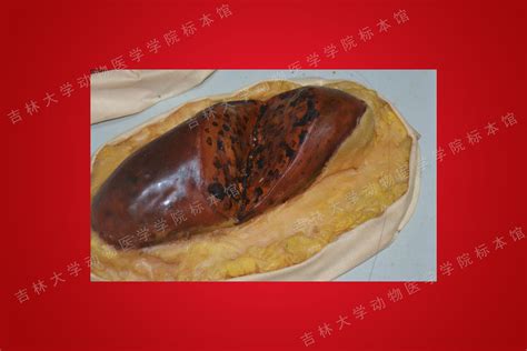 皮肤炭疽图片