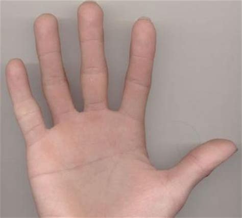 看手相: “断掌”掌纹代表了什么?__凤凰网