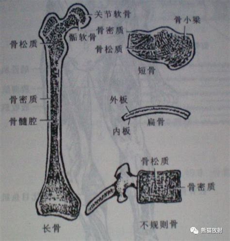 骨小梁示意图图片