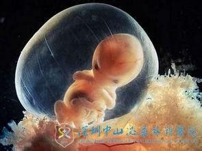 培养成的胚胎就能做试管婴儿吗-深圳中山妇产医院