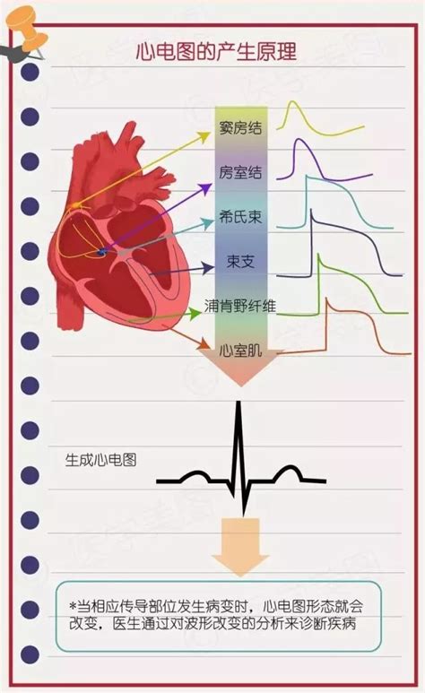 正常心电图，正常心电图波形