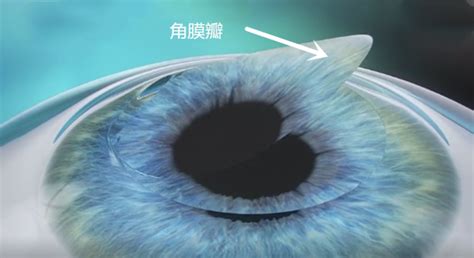 phloem fiber 的图像结果