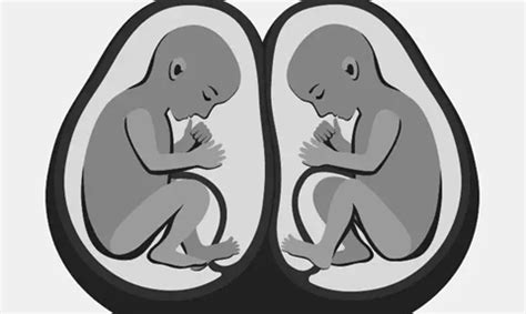双胎妊娠临床处理指南（2020更新）摘要（二）_胎儿_诊断_等级