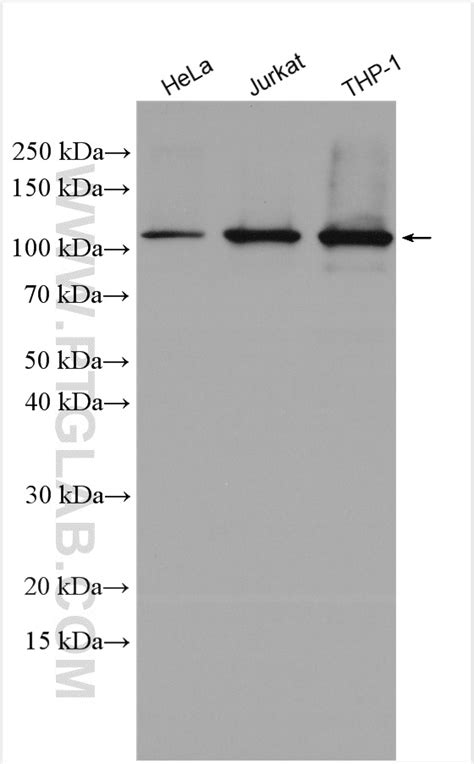 PARP1 antibody (13371-1-AP) | Proteintech | 武汉三鹰生物技术有限公司