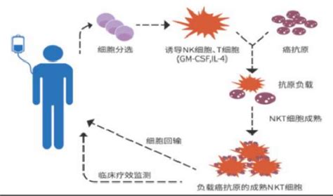 抗癌四大法宝：CIK细胞、DC细胞、NK细胞、CTL/TCR,你分得清吗？ - 知乎