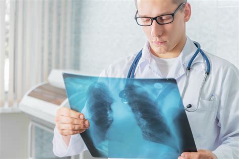 成人肺结核的规范治疗要点解读-专业文章