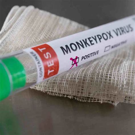 世卫组织警告：猴痘病毒“持续传播”将危及弱势群体！|世卫组织|疫苗|猴痘_新浪新闻