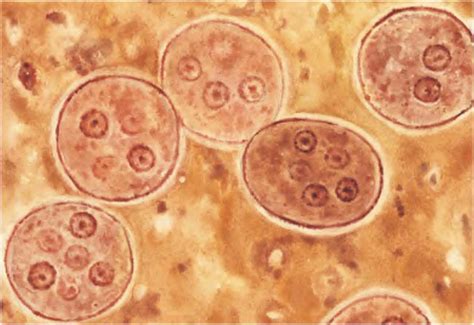 图6 溶组织内阿米巴包囊-人体寄生虫学彩色图谱-医学