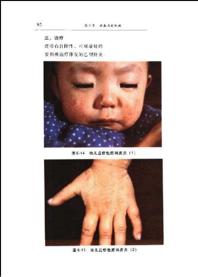 资料下载：常见皮肤病鉴别诊疗彩色图谱.pdf-皮肤性病学-电子书
