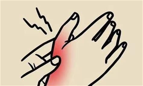 手部疼痛肿胀可能是腱鞘炎在作怪？千万别不当回事！！！ - 知乎
