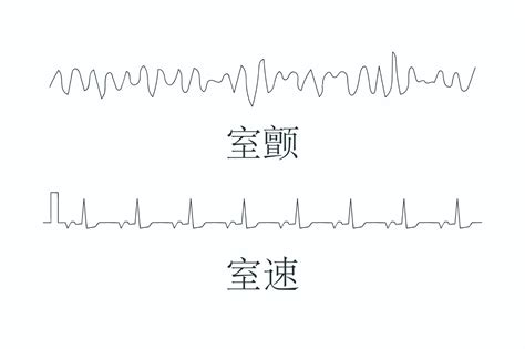 那个心脏骤停倒在北京地铁的人 终于用上了AED_凤凰网