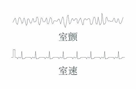 羽毛球75速和76速外表区别