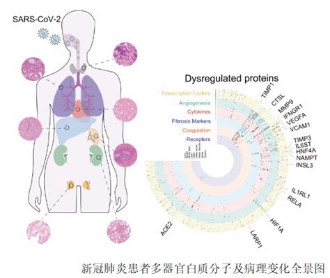 2019新型冠状病毒小鼠感染模型的建立--中国科学院武汉病毒研究所