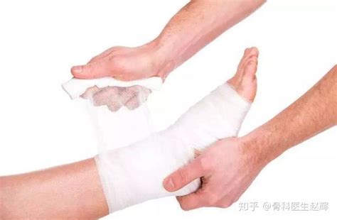 脚踝扭伤图片