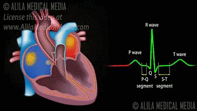 心机械图-心血管-医学