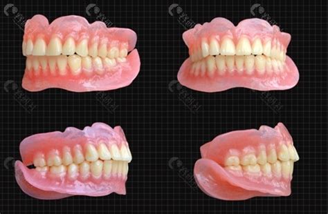 固易美数字化全口义齿-胶托类-云南家红齿科技术股份有限公司