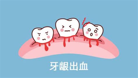 喉咙往外吸有血怎么回事，一吸嗓子吐出唾液里就有血怎们回事