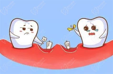 缺了一颗牙怎么补？单颗牙齿缺失修复方法有哪些？_口腔医院牙科门诊专家在线问答_皓齿口腔网