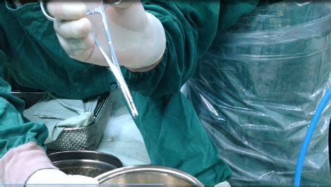 科学网—膝关节镜微创手术取出膝关节后内侧室游离体技术（图文） - 高绪仁的博文