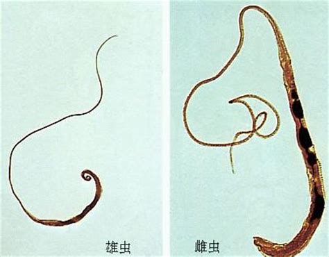 人体寄生虫 - 搜狗百科