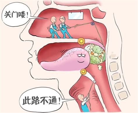 食道图片