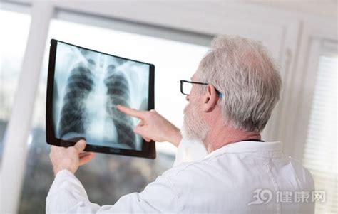 到了肺癌晚期，身体有什么感觉？5个症状很难熬！